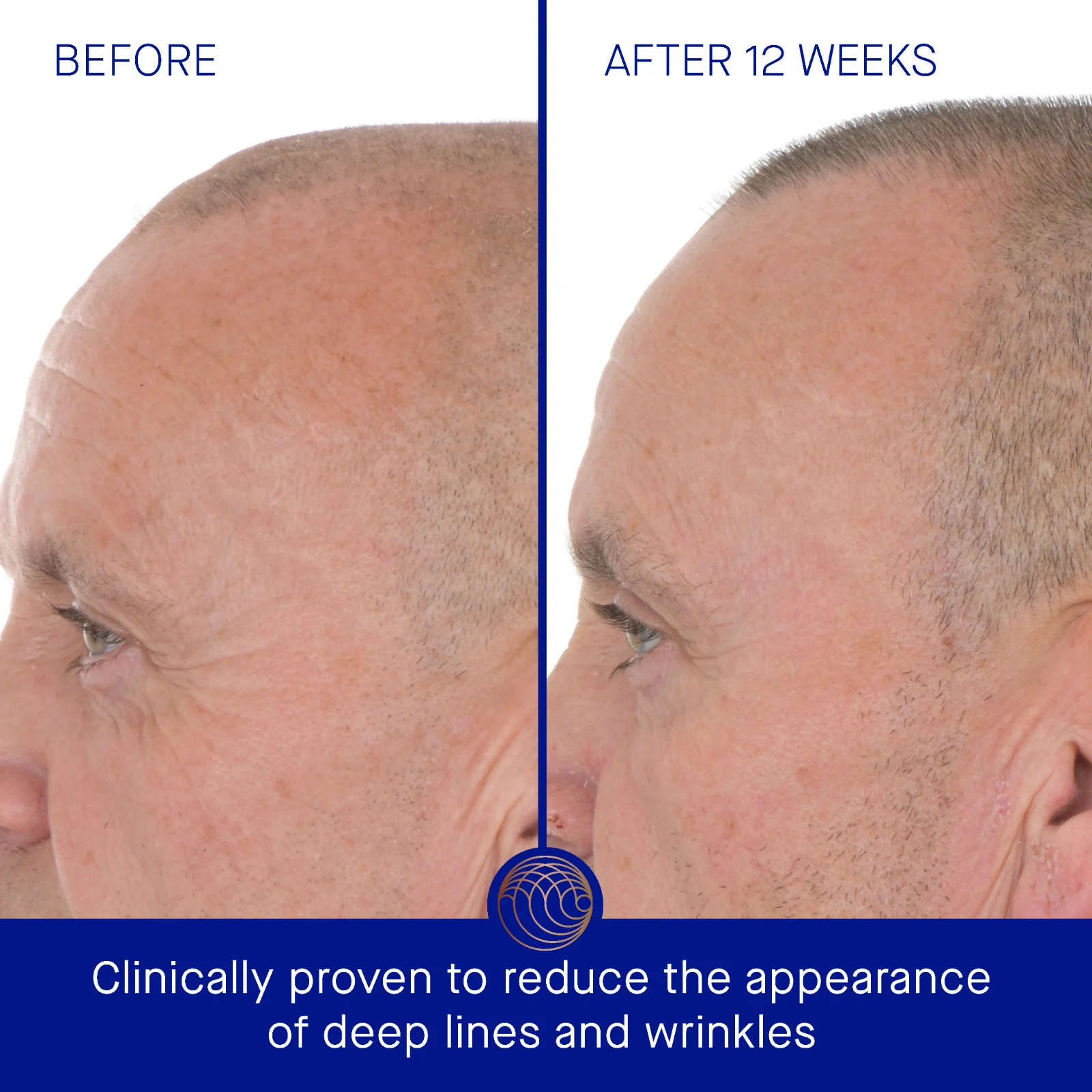 The Retinol Serum
