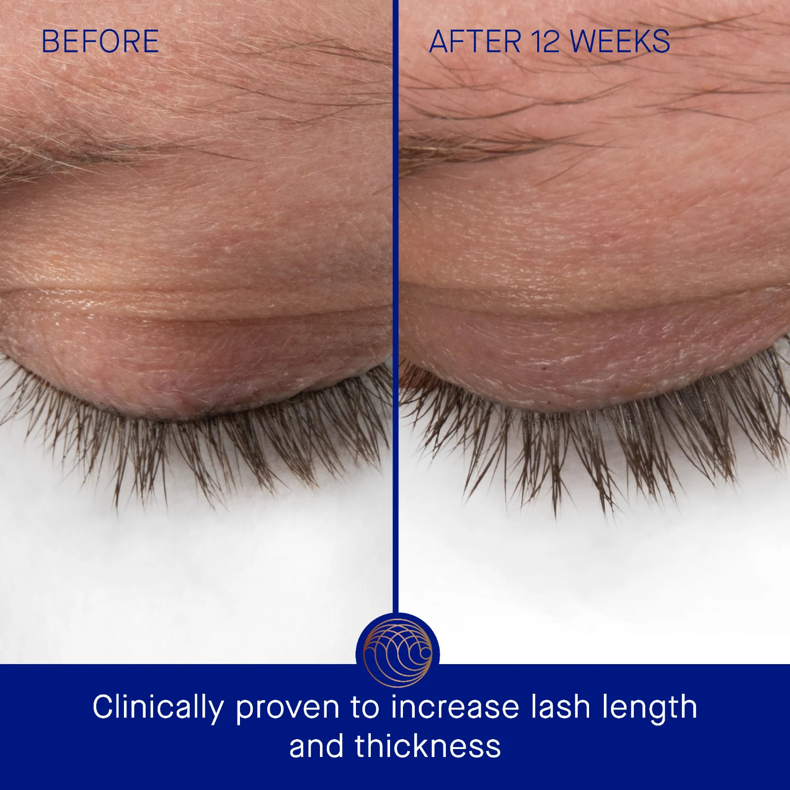 The Eyebrow & Lash Enhansing Serum