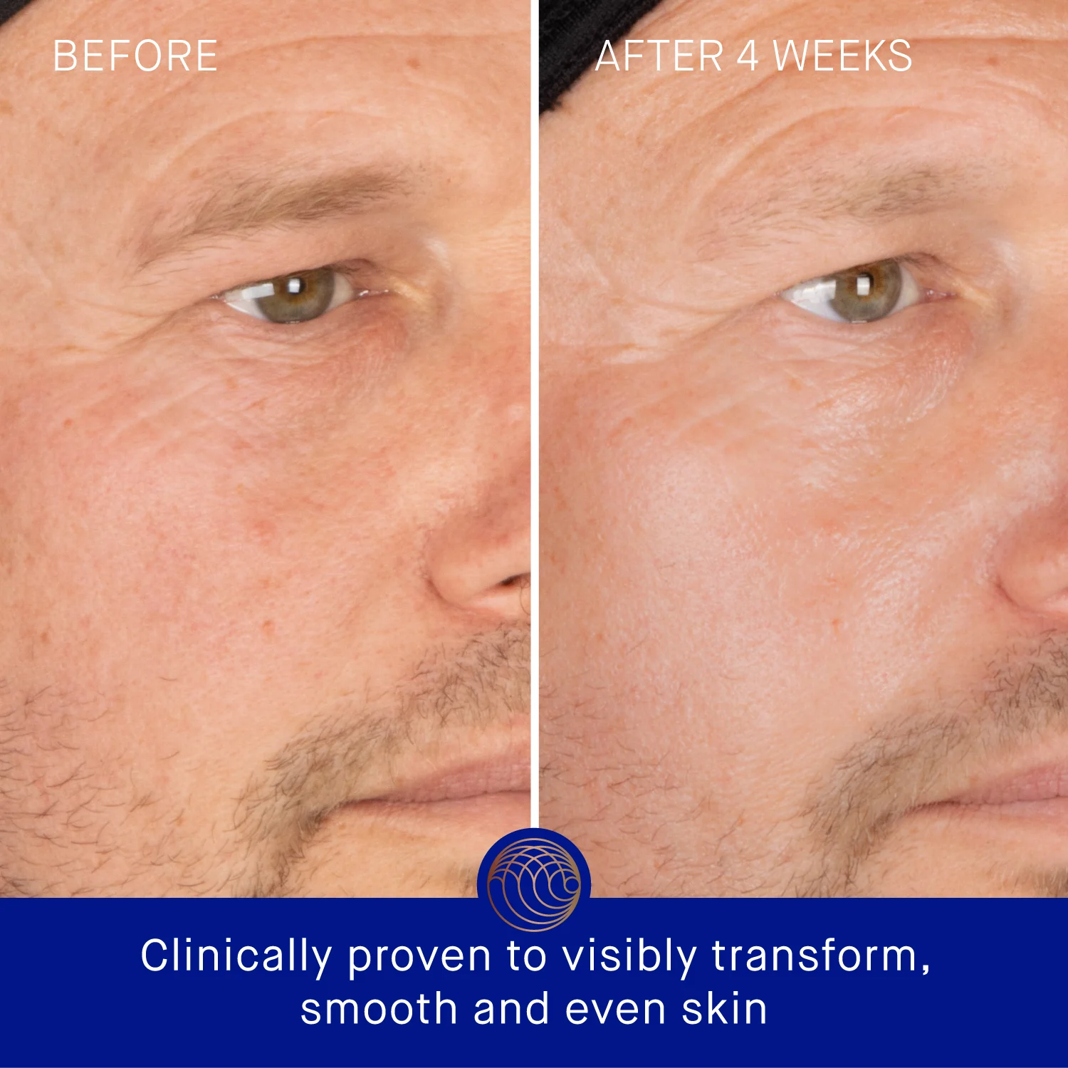 The Skin Infusion
