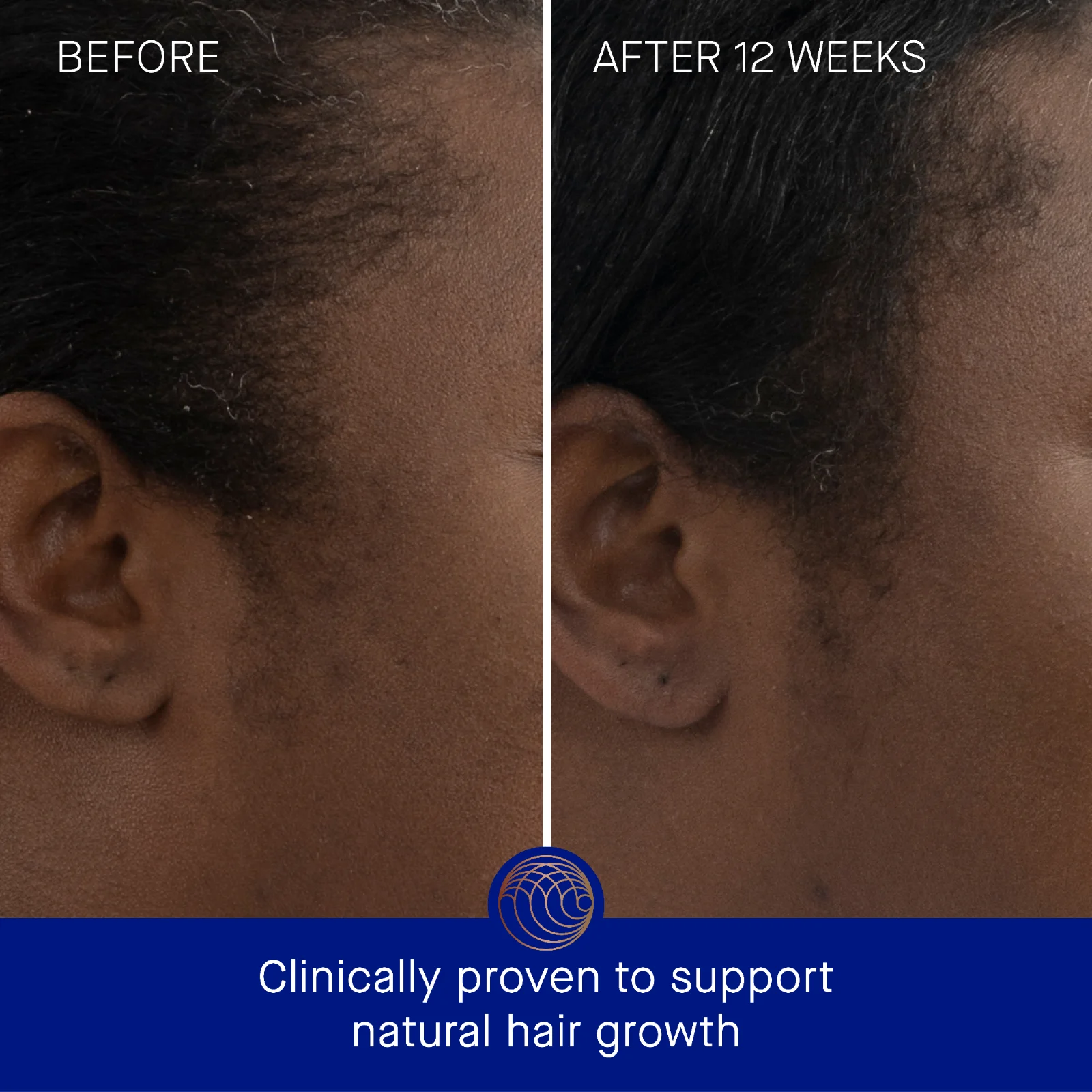 The Scalp Treatment