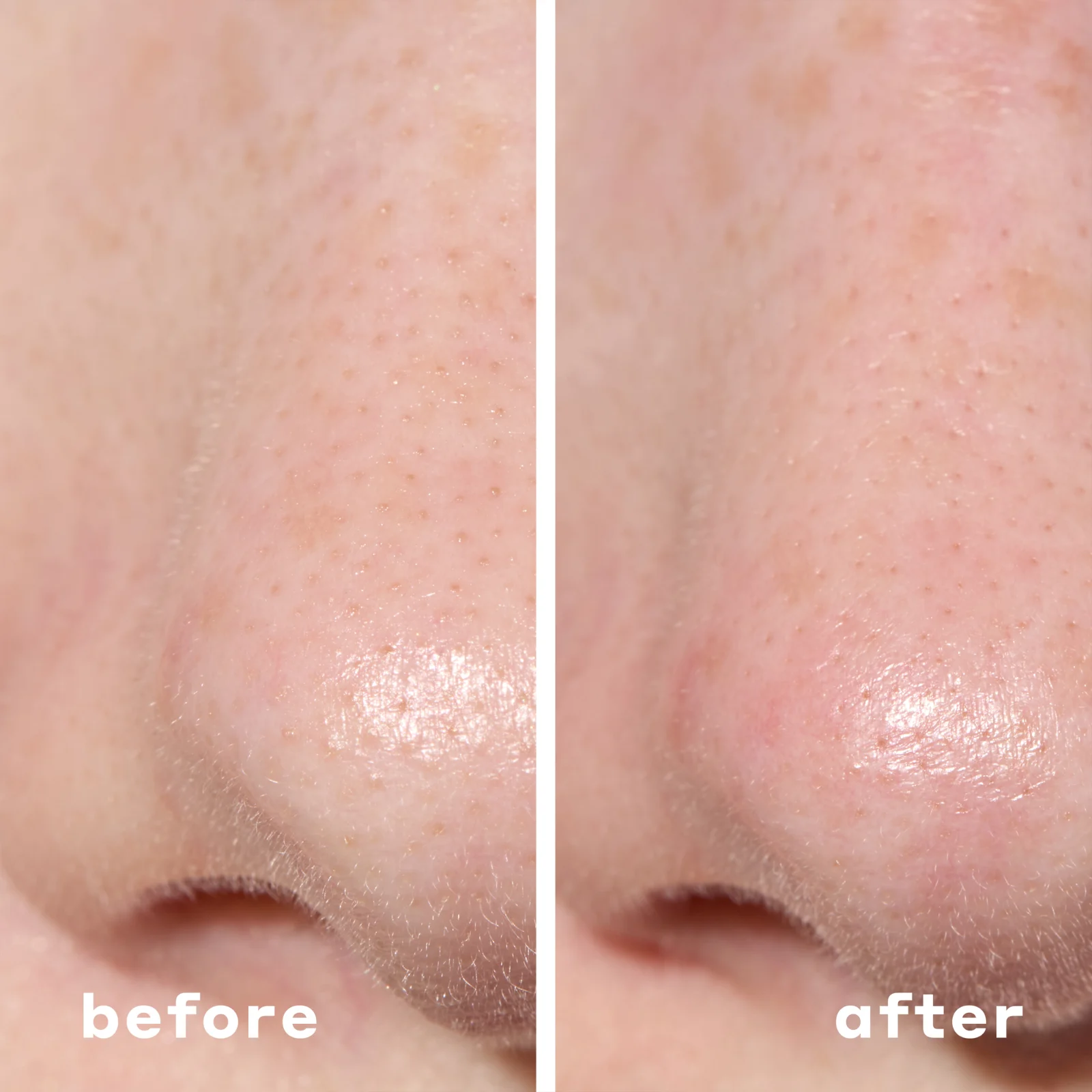 2-in-1 Deep Cleansing Pore Strips