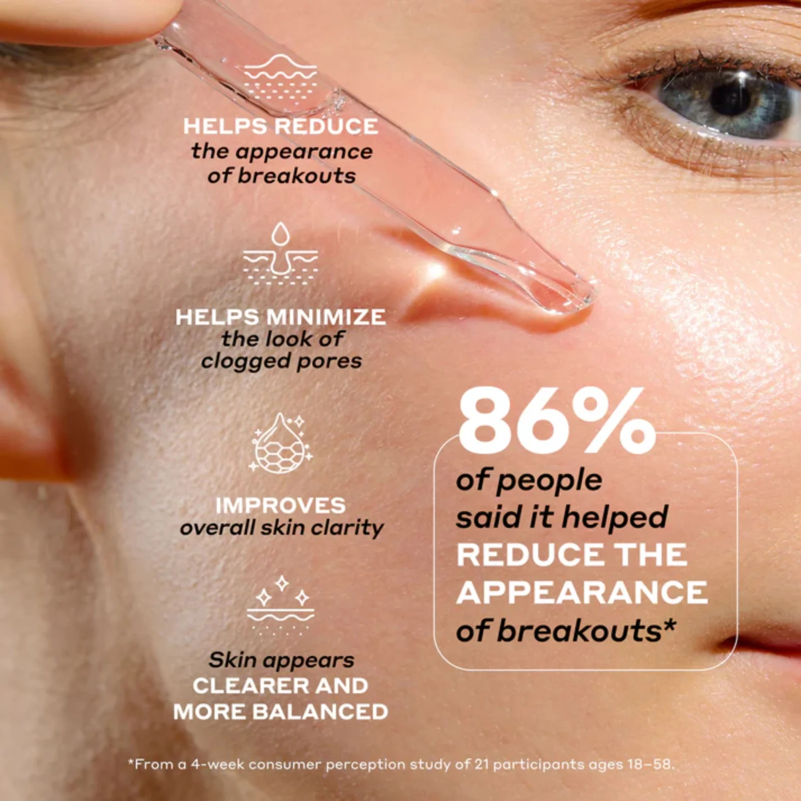 Clarifying Serum W/ Azelaic Acid