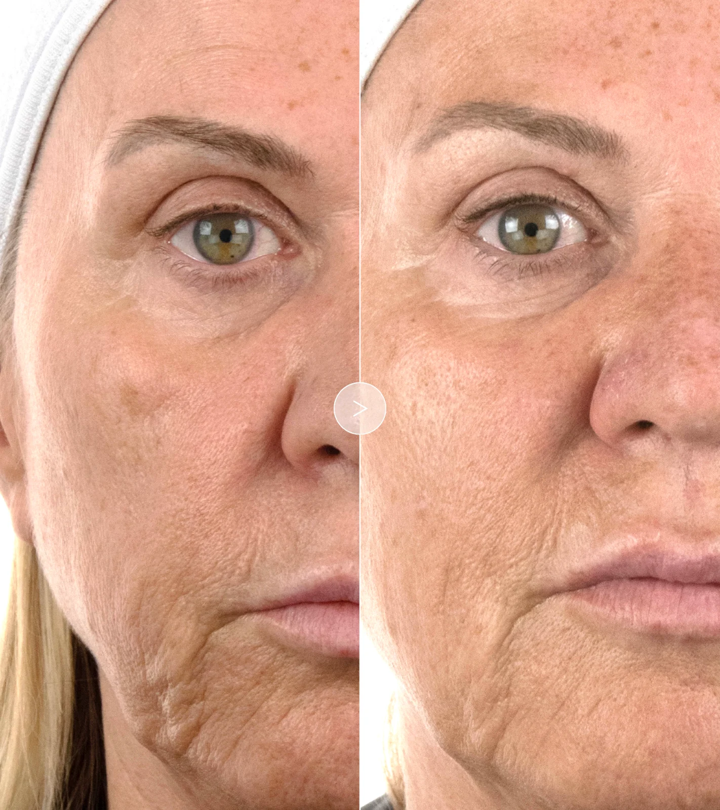 The Absolute Intense Renewal Serum