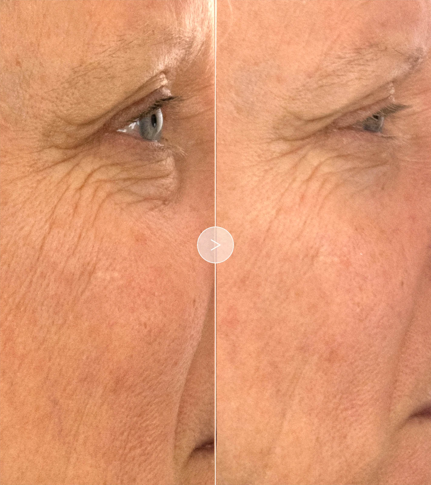 The Absolute Restoring Eye Cream