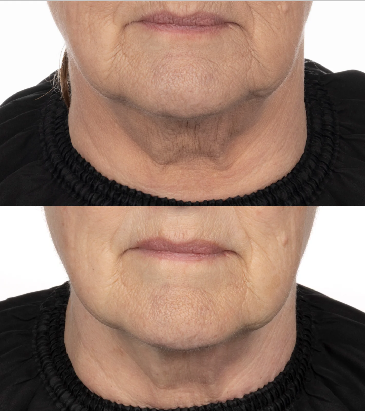 The Absolute Peptide8 Night Serum