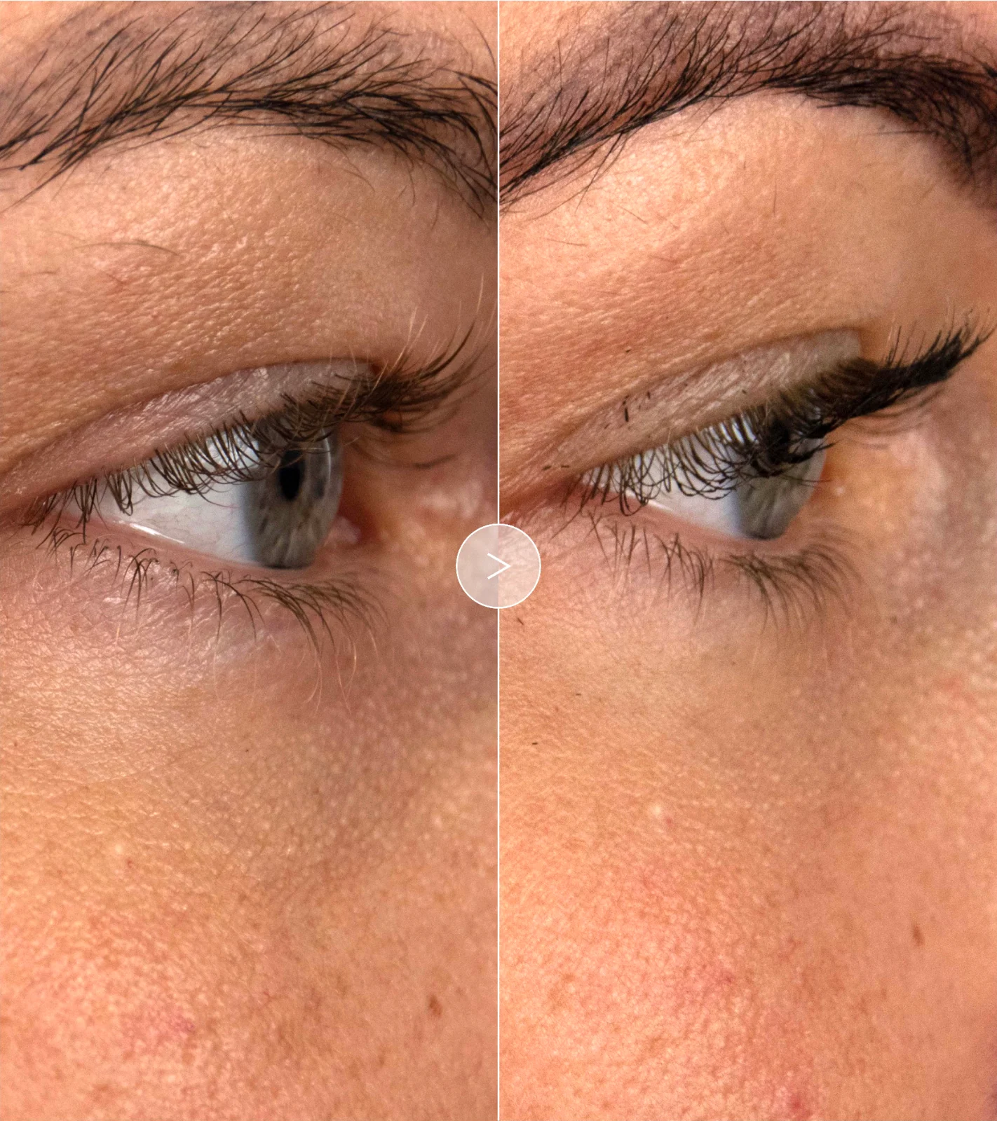 The Brilliant Vibrant Eye Infusion
