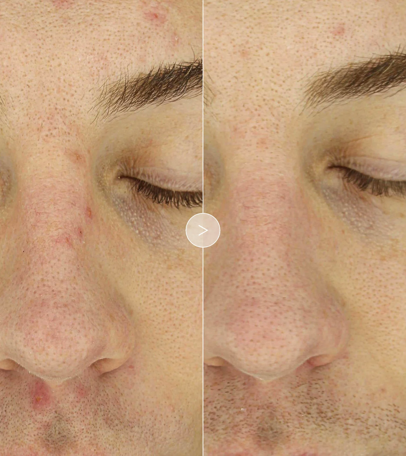 The Exceptional Overnight Chronobiology Peel