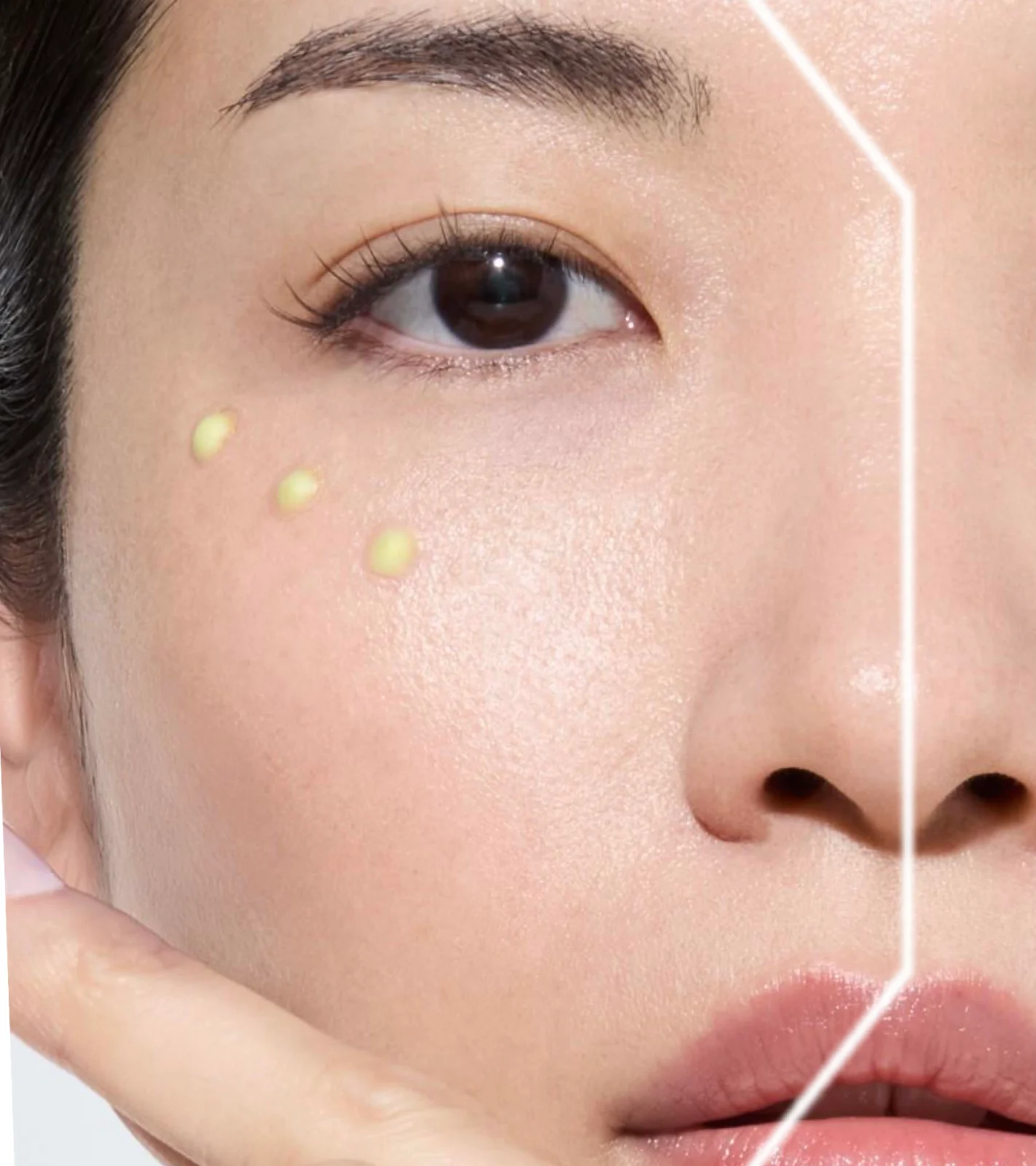The Exceptional Eye Lift