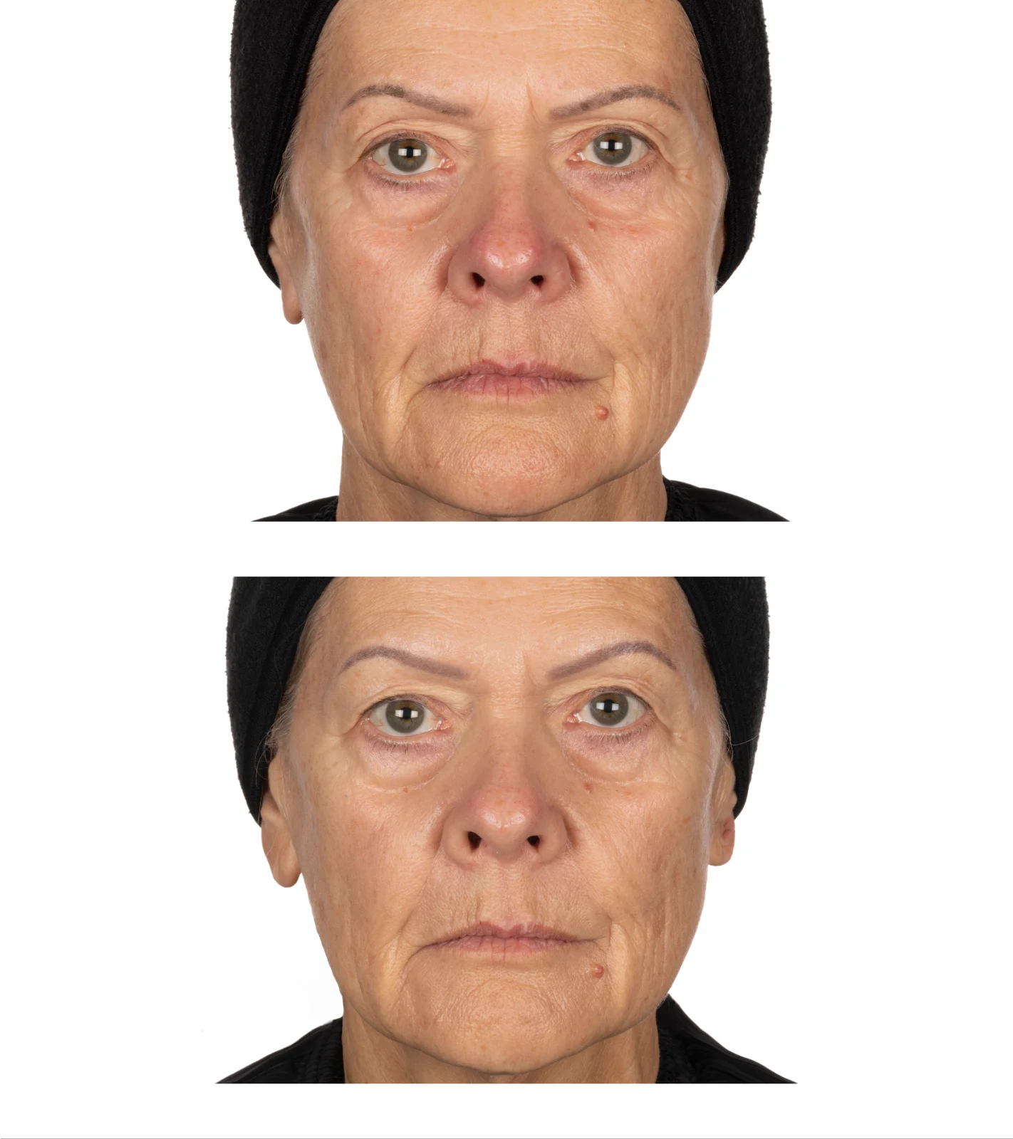 The Exceptional Repair Reset Cream